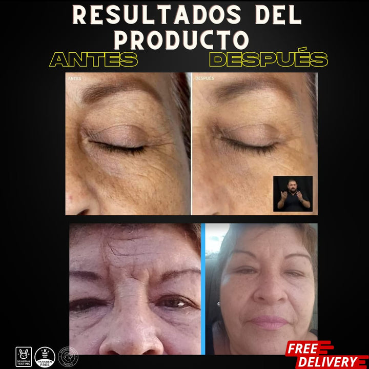 Suero Facial Anti-Edad con Ácido Hialurónico