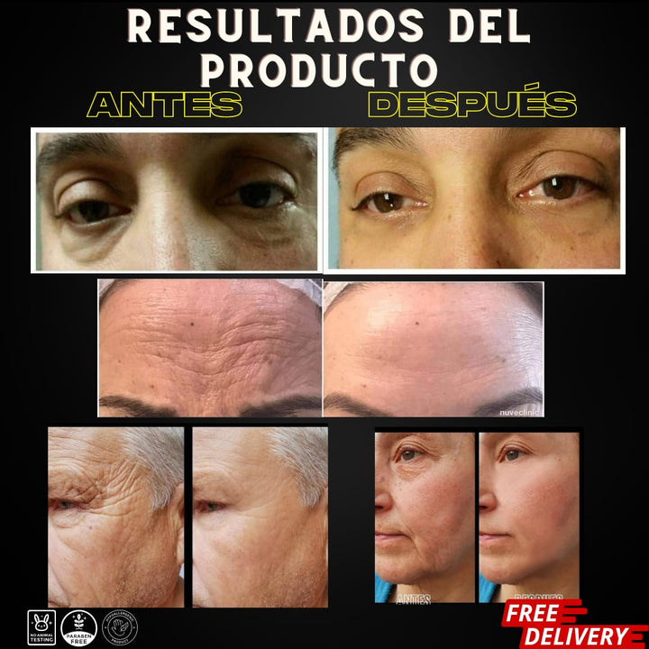 Suero Facial Anti-Edad con Ácido Hialurónico